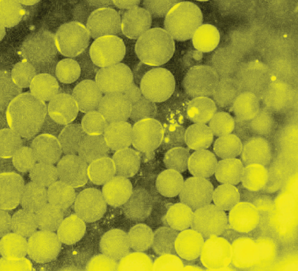  A third way to generate a laser in living cells is to inject dye into the large oil blobs that are naturally found in fat cells, before activating them with light. Image courtesy of Matjaž Humar and Seok-Hyun Yun