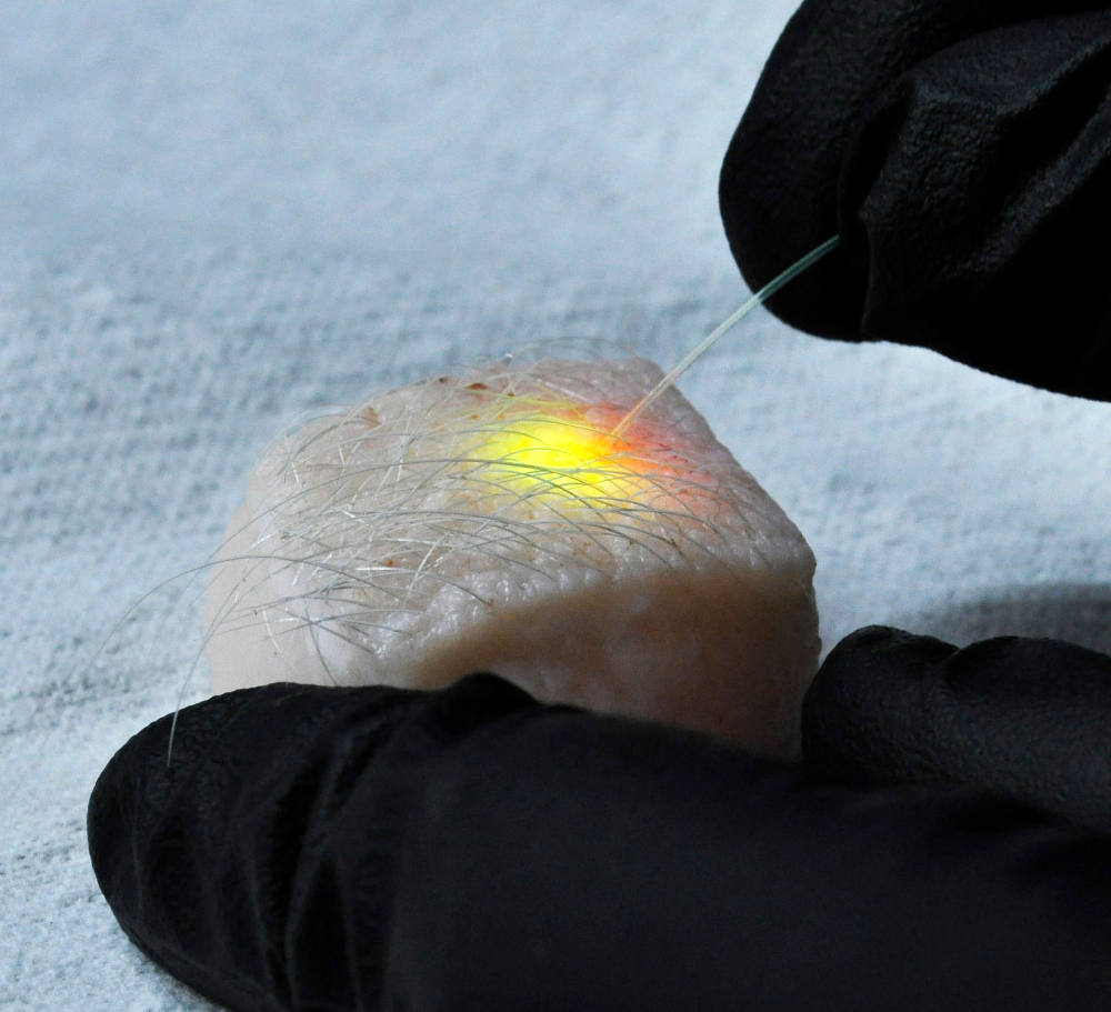 In this case, researchers have been able to activate the ‘natural’ lasers from fat cells in pigs by inserting optical fibres just below the skin to excite the dye.  Image courtesy of Matjaž Humar and Seok-Hyun Yun