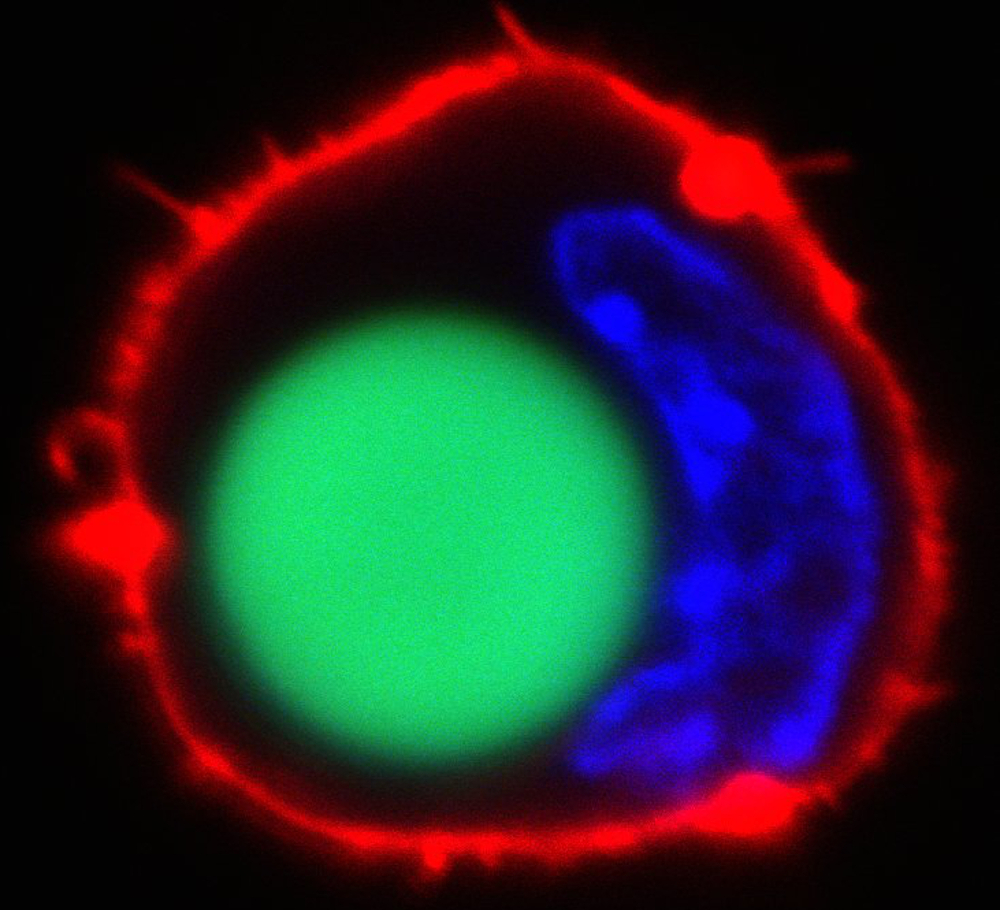 Researchers vary the size of the bead in each cell so every laser is unique and therefore easy to track. This can help scientists follow individual cells and reveal, for example, how cancer cells migrate through the body. Image courtesy of Matjaž Humar and Seok-Hyun Yun