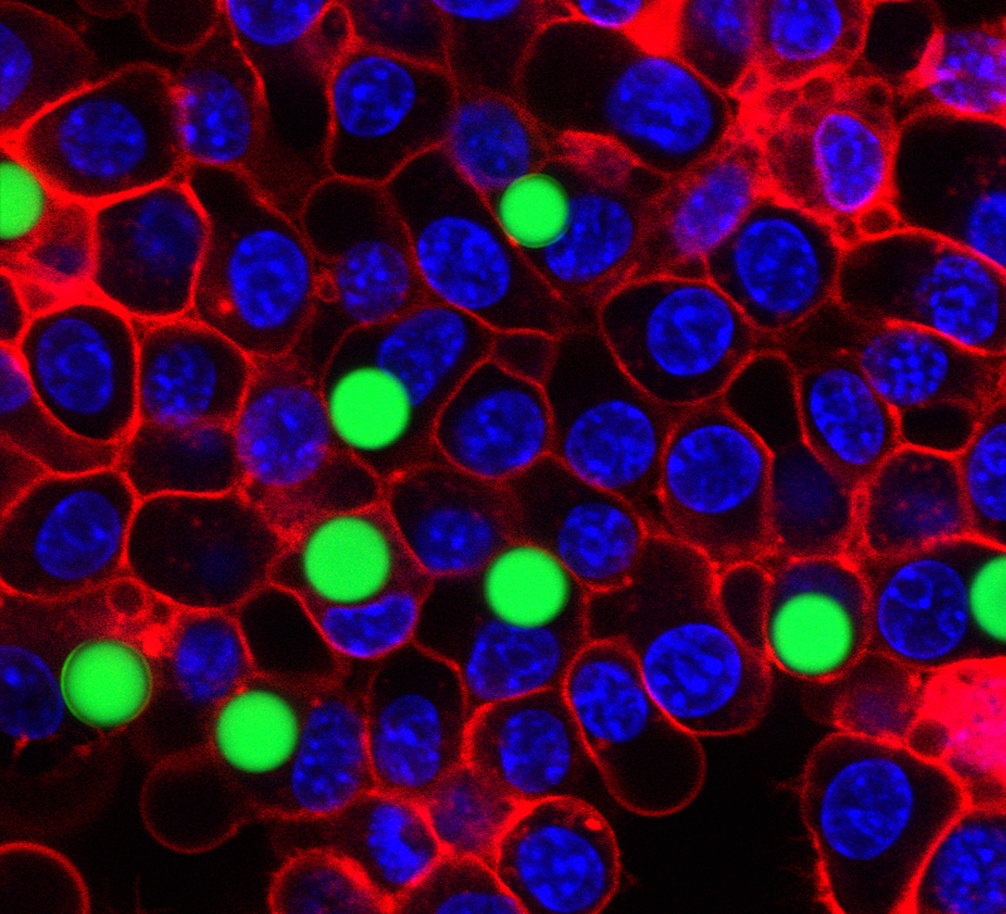 Scientists can uniquely tag thousands of cells with solid polystyrene beads that are dyed with a green fluorescent compound. They shine light on the cell to excite this fluorescent dye, which causes the beads to generate a laser beam. Image courtesy of Matjaž Humar and Seok-Hyun Yun