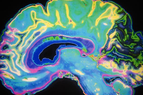  Modern scanning technology such as functional magnetic resonance imaging (fMRI) is helping scientists to explore questions about how the brain processes sensory information. ©Shutterstock/ DaisyDaisy