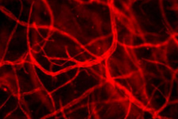 Artificial skin is being grown with blood vessels pre-formed inside it. Image copyright The Tissue Biology Research Unit (TBRU), University of Zurich.
