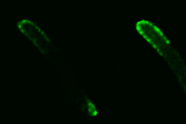 Fusing bacterial proteins to fluorescent molecules has revealed details about the mechanics of cell division, which could be exploited by a new generation of highly targeted drugs. Image from M. Pazos, M. Casanova, P. Palacios, W. Margolin, P. Natale, and M. Vicente. 2014. FtsZ placement in nucleoid-free bacteria. PLoS ONE 9(3): e91984. Courtesy of DIVINOCELL.