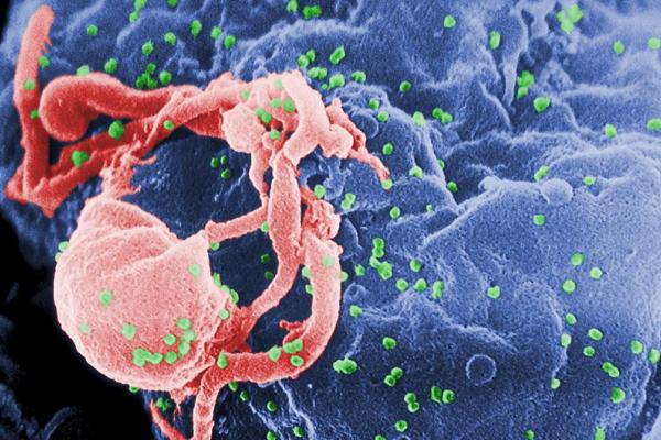 HIV claims thousands of lives every day. Image credit: 'HIV-budding-Color' by CDC/ C. Goldsmith, P. Feorino, E. L. Palmer, W. R. McManus is in the public domain