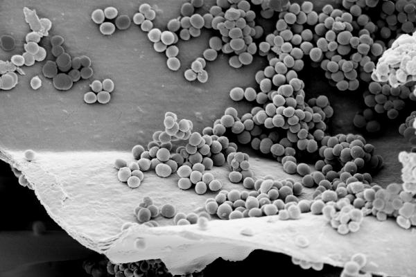 Antibiotic-resistant 'superbugs' have become a significant health threat. © CNRS Photothèque - UMR6522