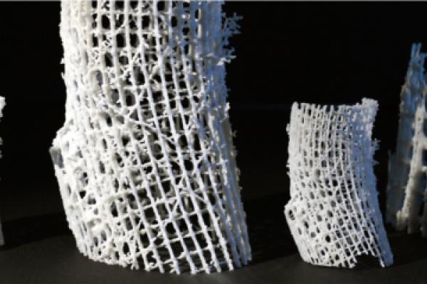 3D-printed bone scaffolding, created by BIO-SCAFFOLDS.