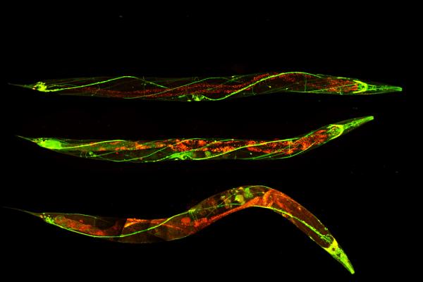 The worm C. elegans has a nervous system remarkably similar to that of humans. Researchers are studying it to better understand the link between autophagy and age-related degeneration of the nervous system.  © Nektarios Tavernarakis, 2022