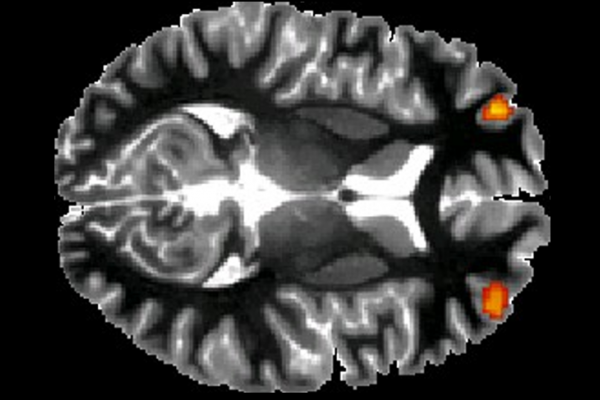 Researchers use functional magnetic resonance imaging (fMRI) to reveal brain activity during emotional situations. Image credit: Inge Volman et al. 